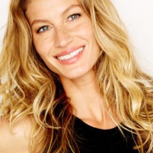 As famosas também têm sardas!